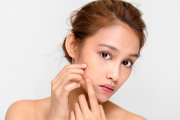 Kem trị sẹo Acnesil