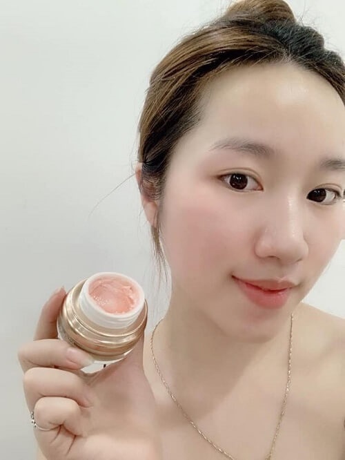 Kem trị sẹo Genie có tốt không