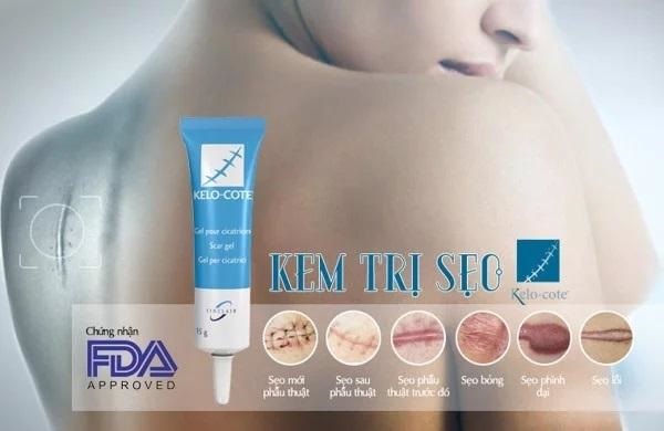 kem trị sẹo kelo cote