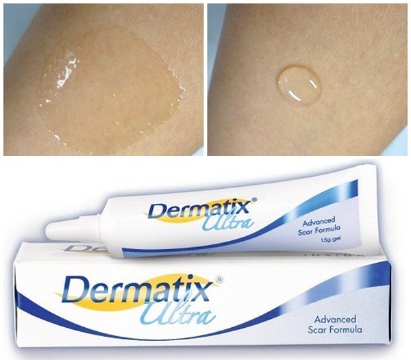 kem trị sẹo dermatix ultra