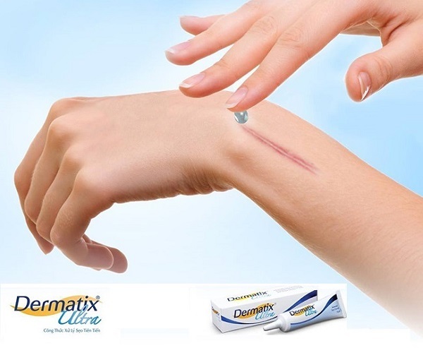 kem trị sẹo dermatix ultra