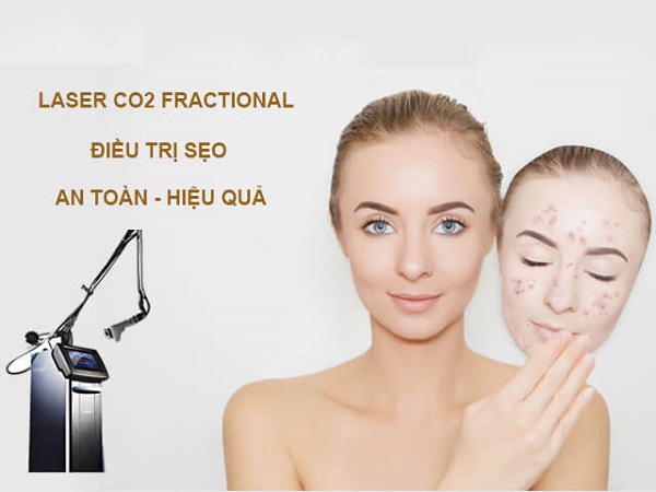 tri-seo-bang-laser-co2 (1)
