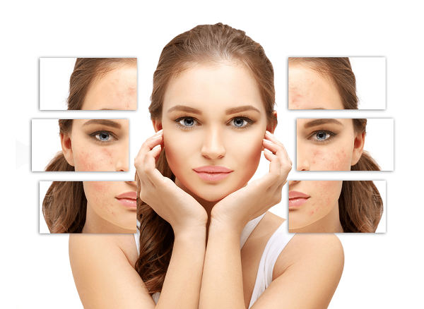 kem-tri-seo-derma-scar-e-gel