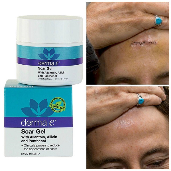 kem-tri-seo-derma-scar-e-gel (1)