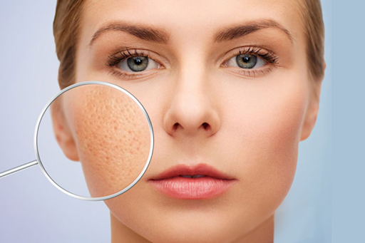 Trị sẹo lồi lõm tại bệnh viện đại học y dược
