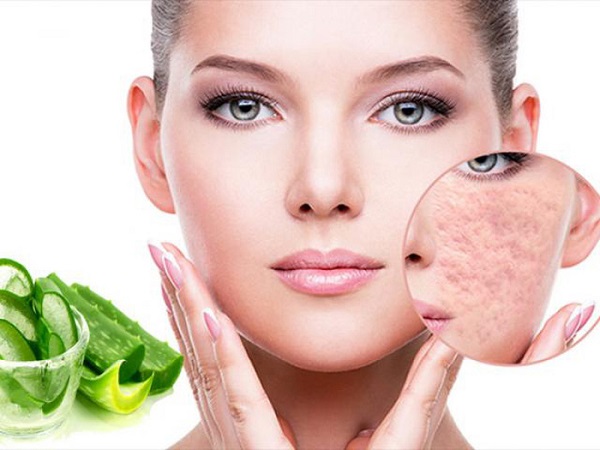 Cách chữa trị sẹo rỗ sẹo mụn bằng nha đam
