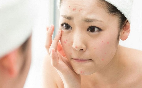 Kem trị sẹo Scar Esthetique mua ở đâu uy tín