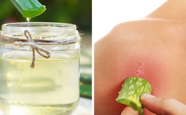 Cách dùng kem thuốc trị sẹo cho bé khi bé bị bỏng