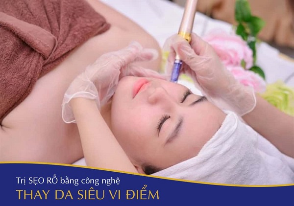 Điều trị sẹo rỗ hết bao nhiêu tiền