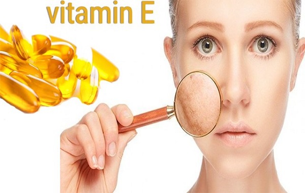 7 cách điều trị sẹo rỗ lâu năm hiệu quả tại nhà