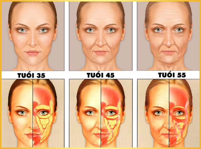 cấy mỡ mặt duy trì được bao lâu