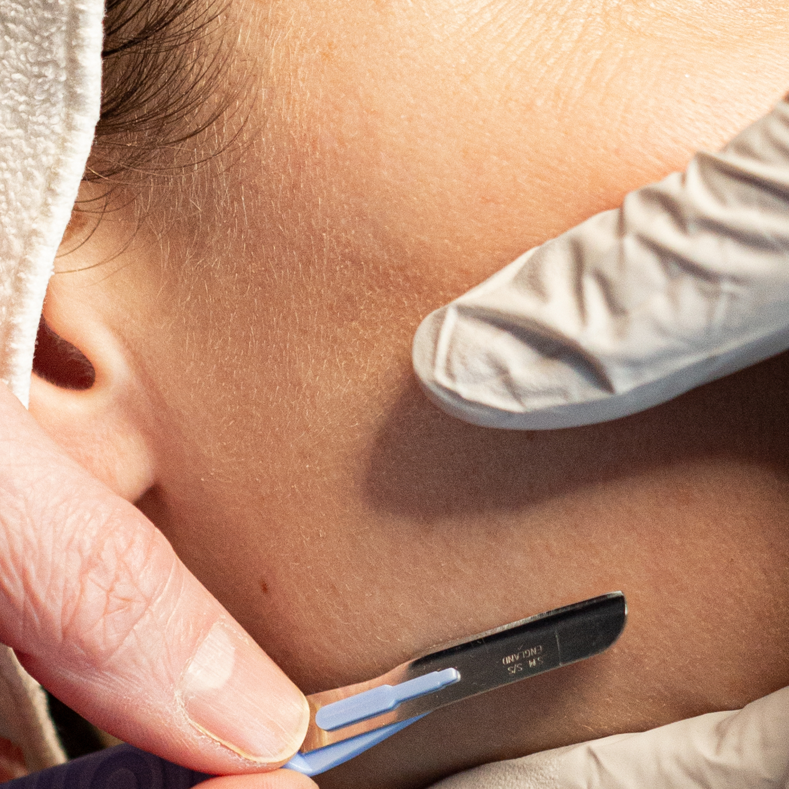 dermaplaning für die perfekt glatte Haut