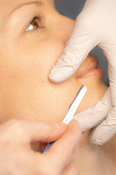 delightfulandpure dermaplaning