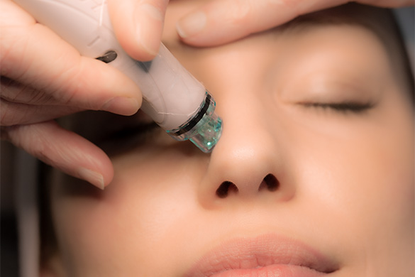 delightfulandpure hydrafacial tiefenreinigung