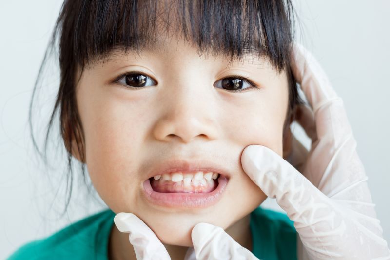 Close-up of child showing loose tooth while gloved hands gently hold their face.