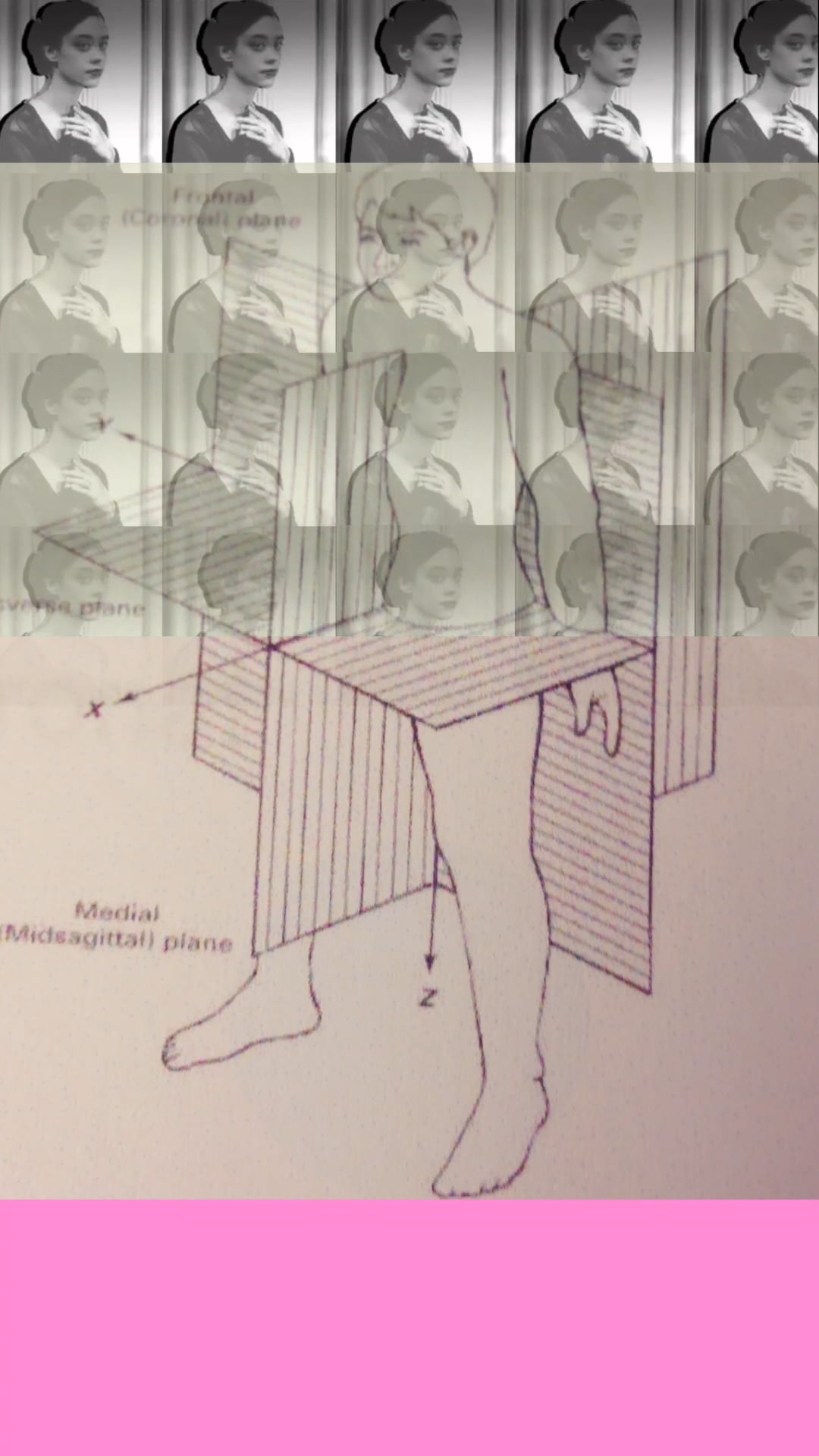 A medical diagram of body planes overlaid with repeated portraits of a woman in grayscale.