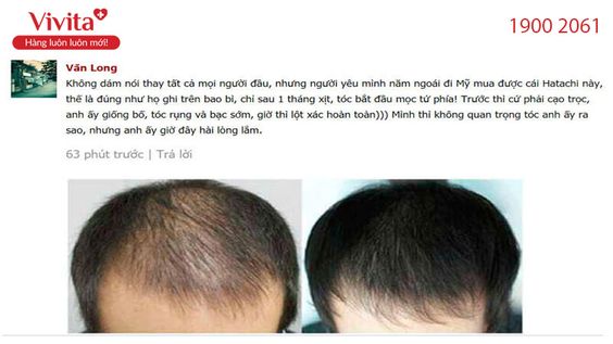 [Bật Mí] Tóc Mộc Linh có tốt không? Giá bao nhiêu? Mua ở đâu?
