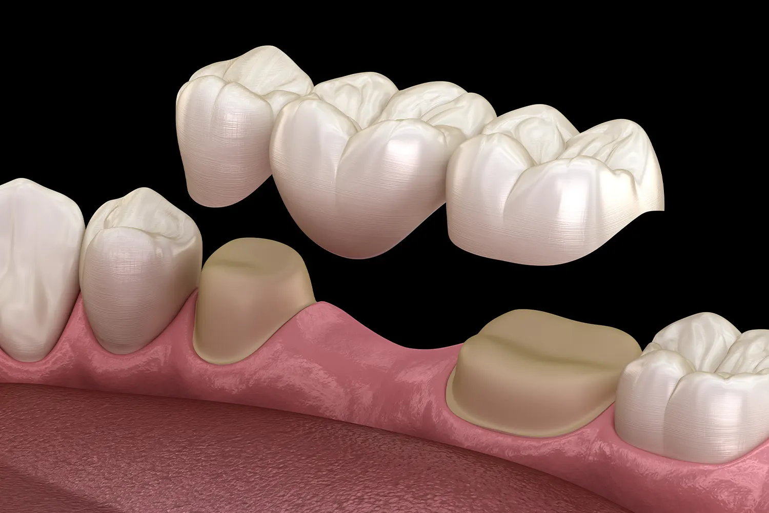 Dental office in Nassau Bay 