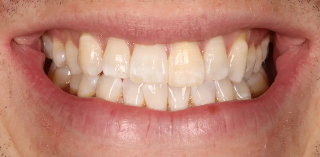 Before Image