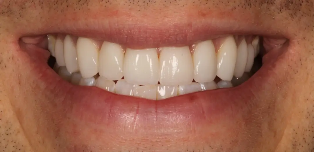 After Image
