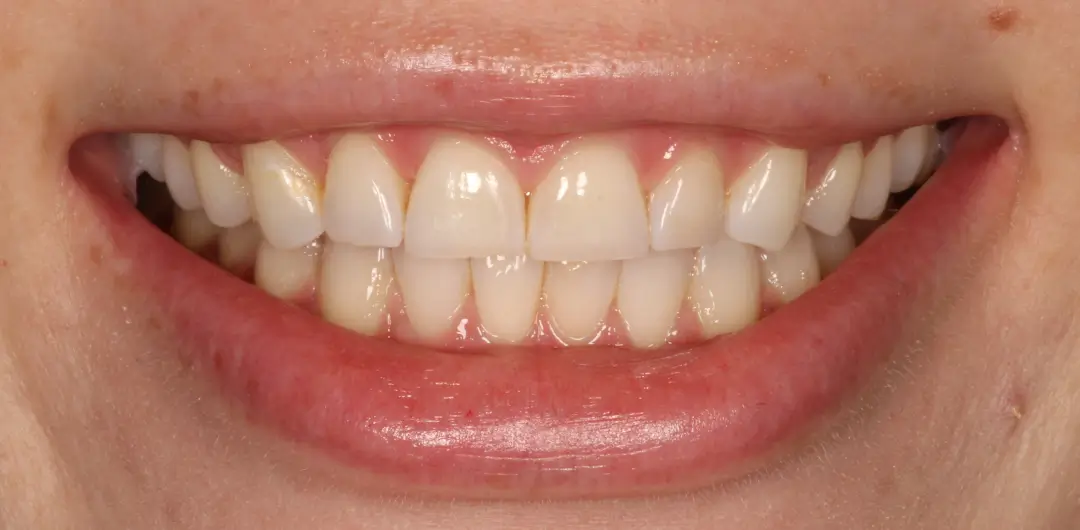 Before Image