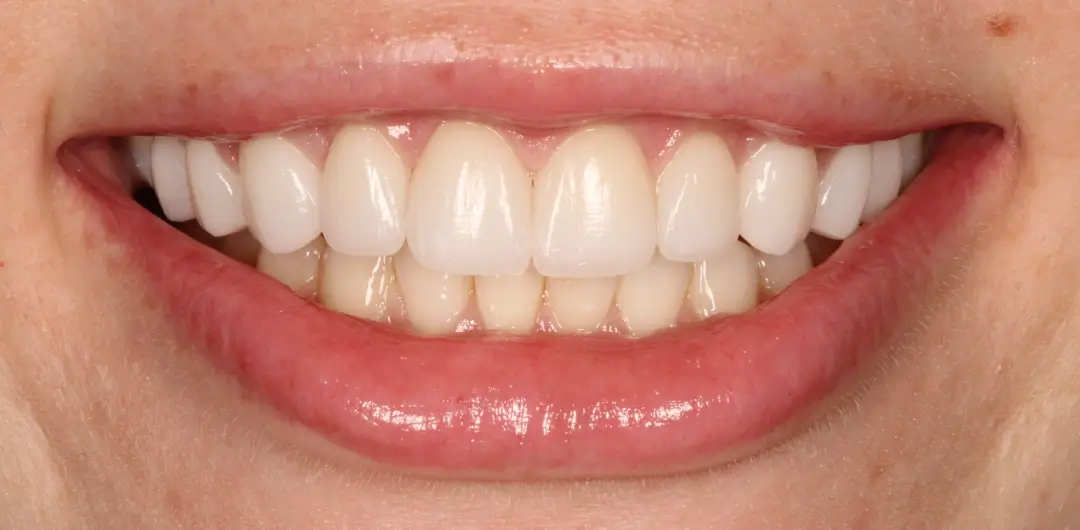 After Image