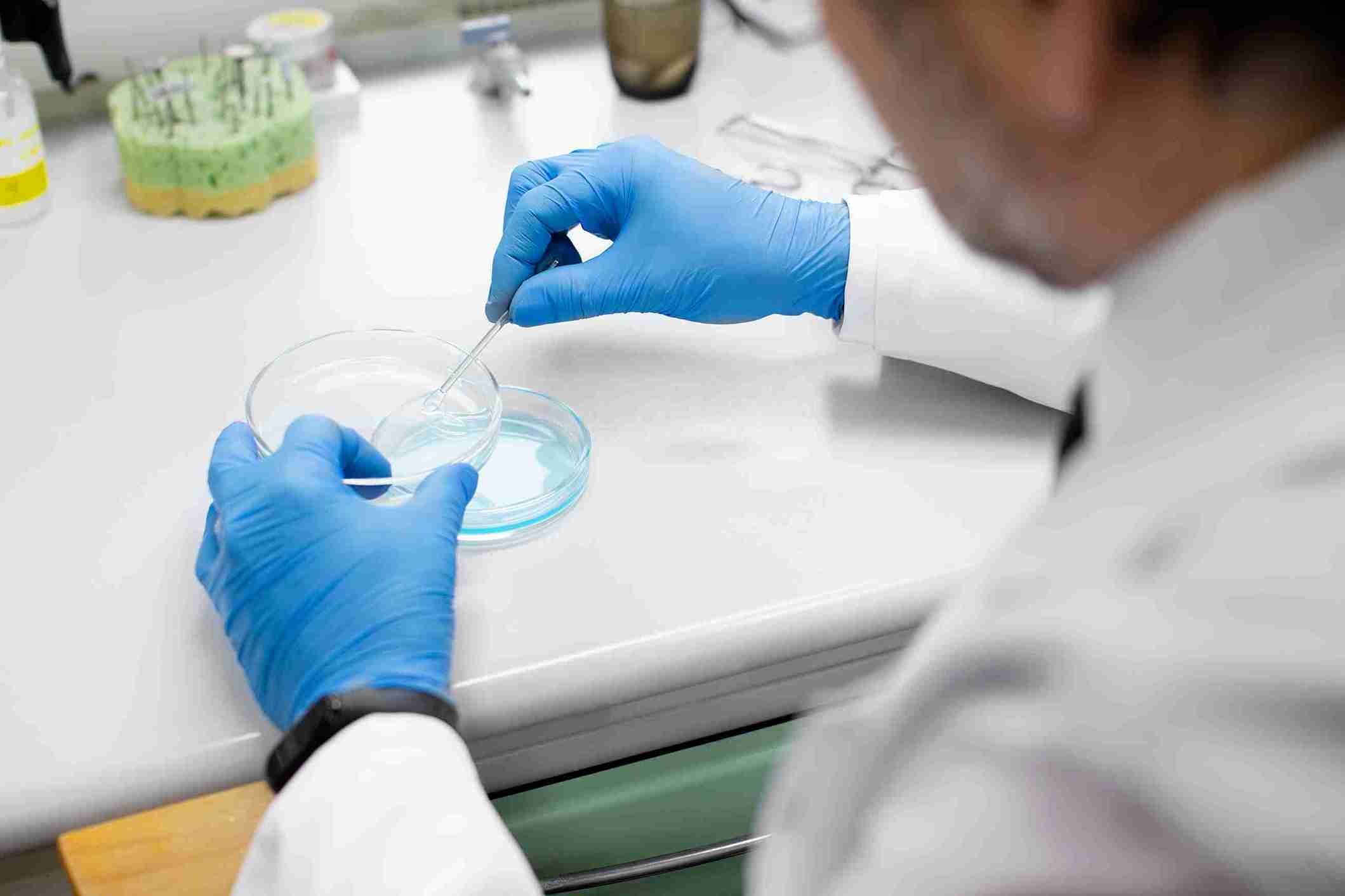 Positive Results of Semen Analysis