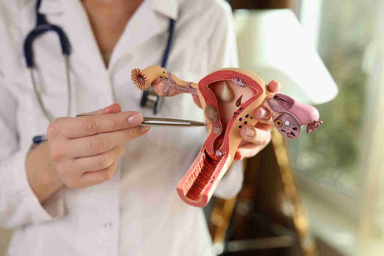 Doctor for PCOS, Menstrual Disorders, or Fertility