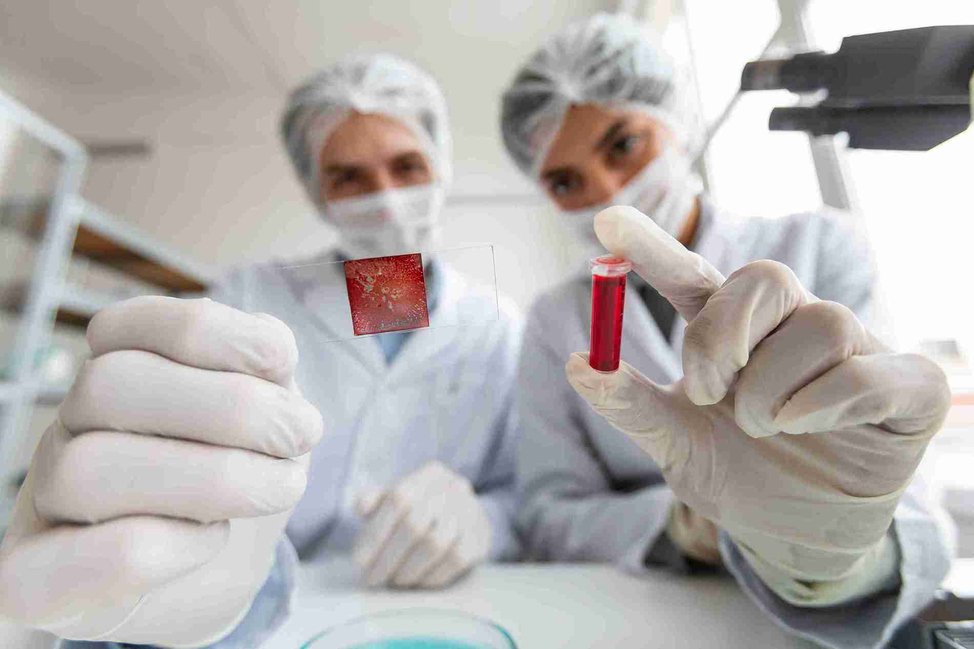 Autoimmune Blood Clotting