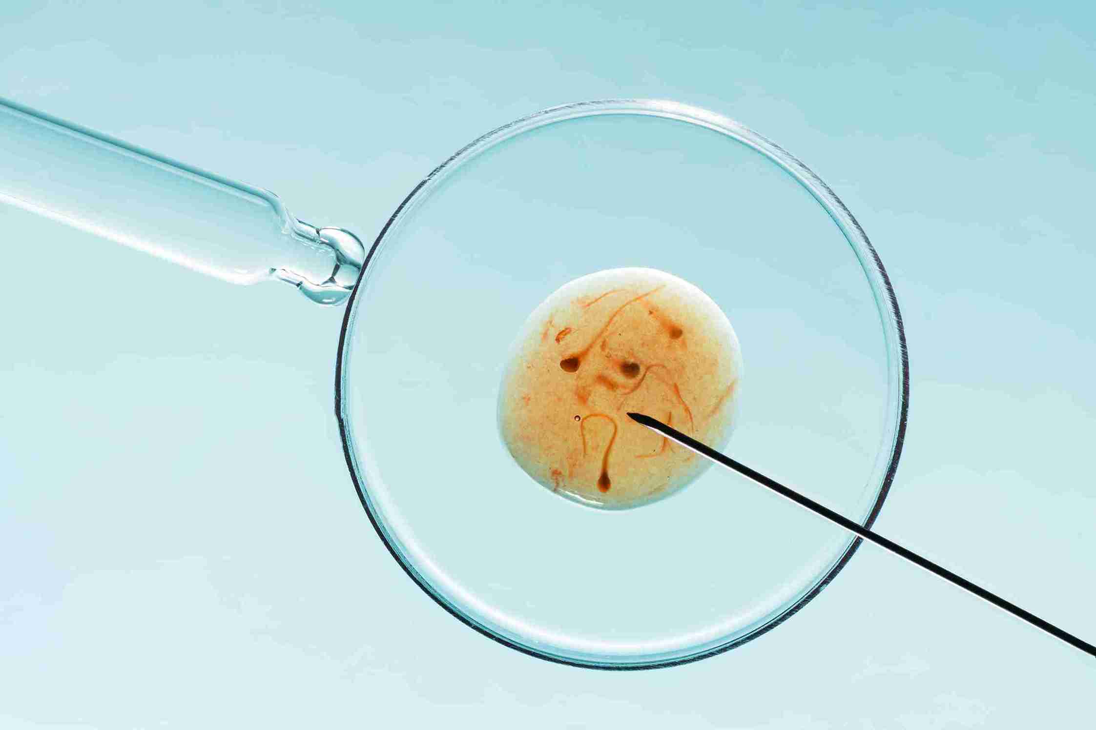 Who is a Good Candidate for GIFT or ZIFT?