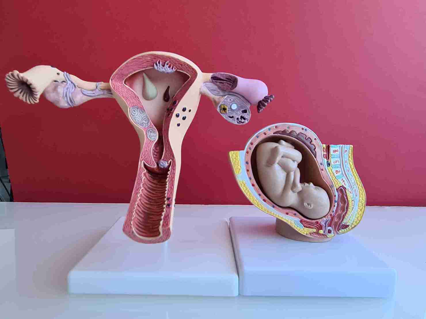 Episiotomy types and degrees are not the same