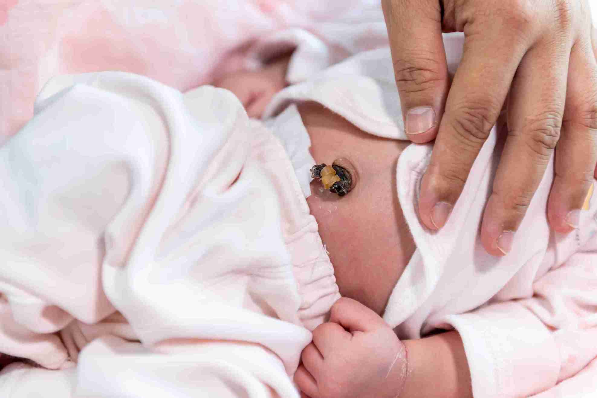 After the Cord Falls Off