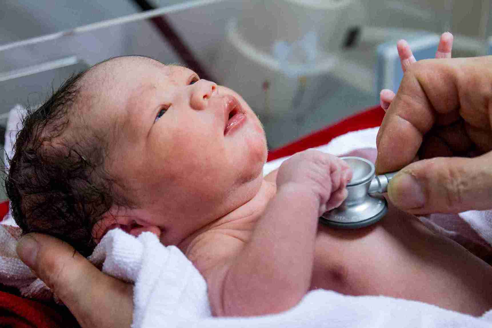 Jaundice Treatment: What the Doctors Do