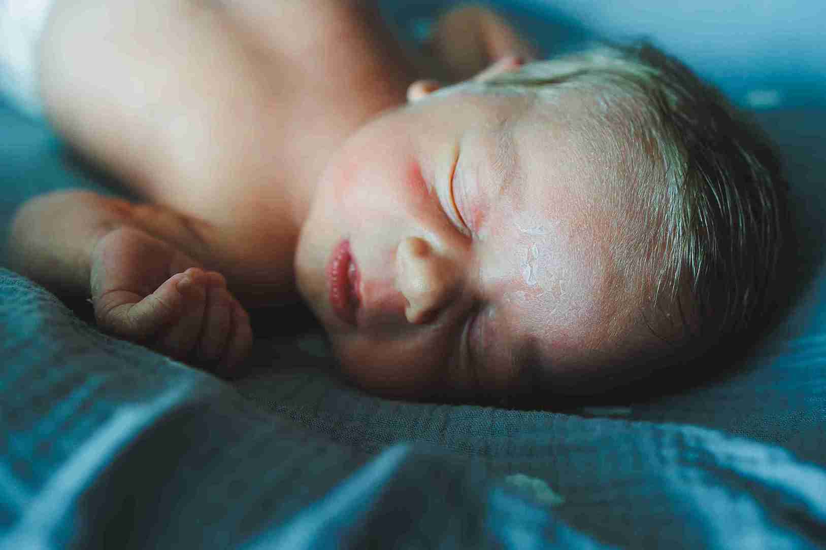 What is Newborn Jaundice?