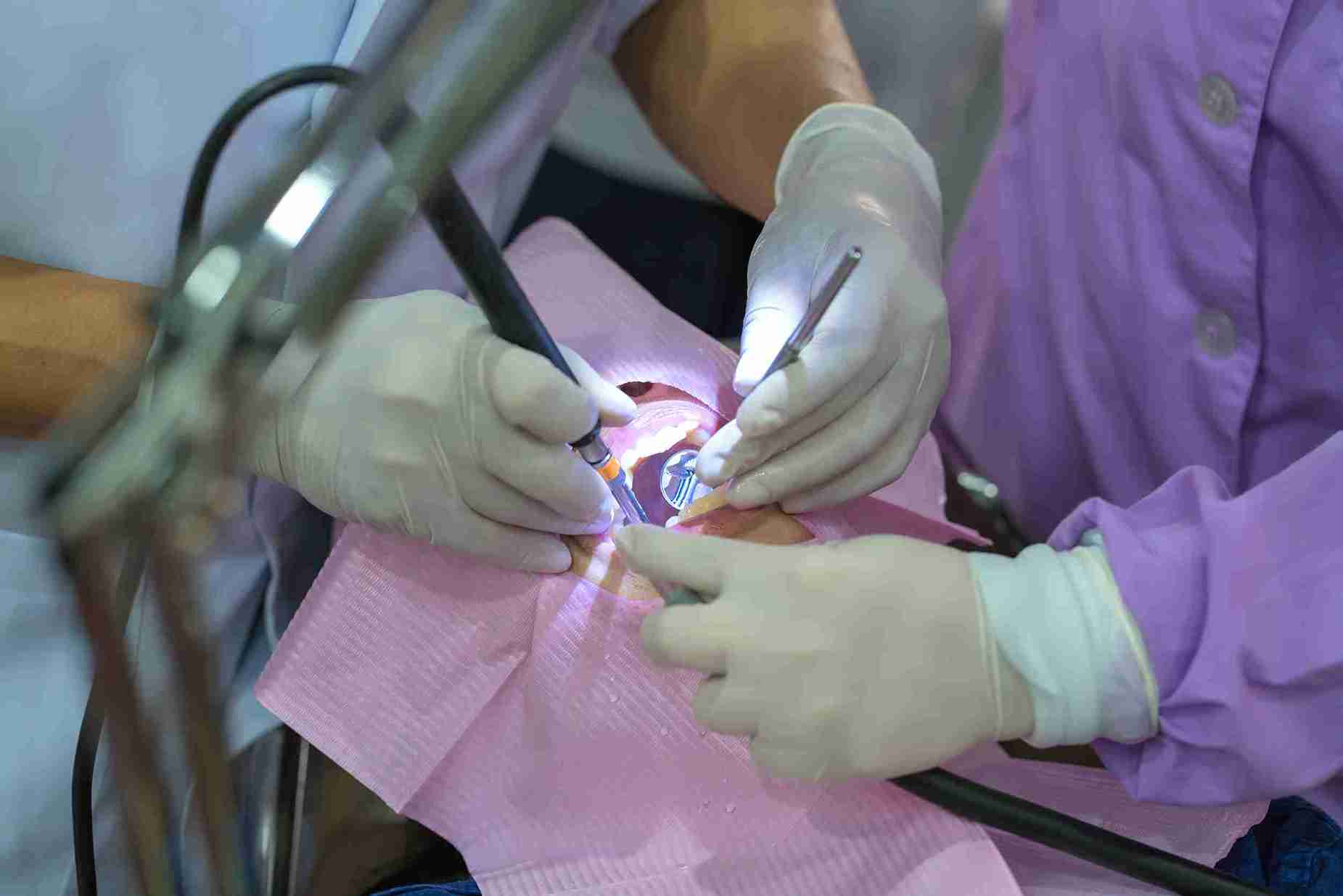 When to Remove an Ovarian Cyst