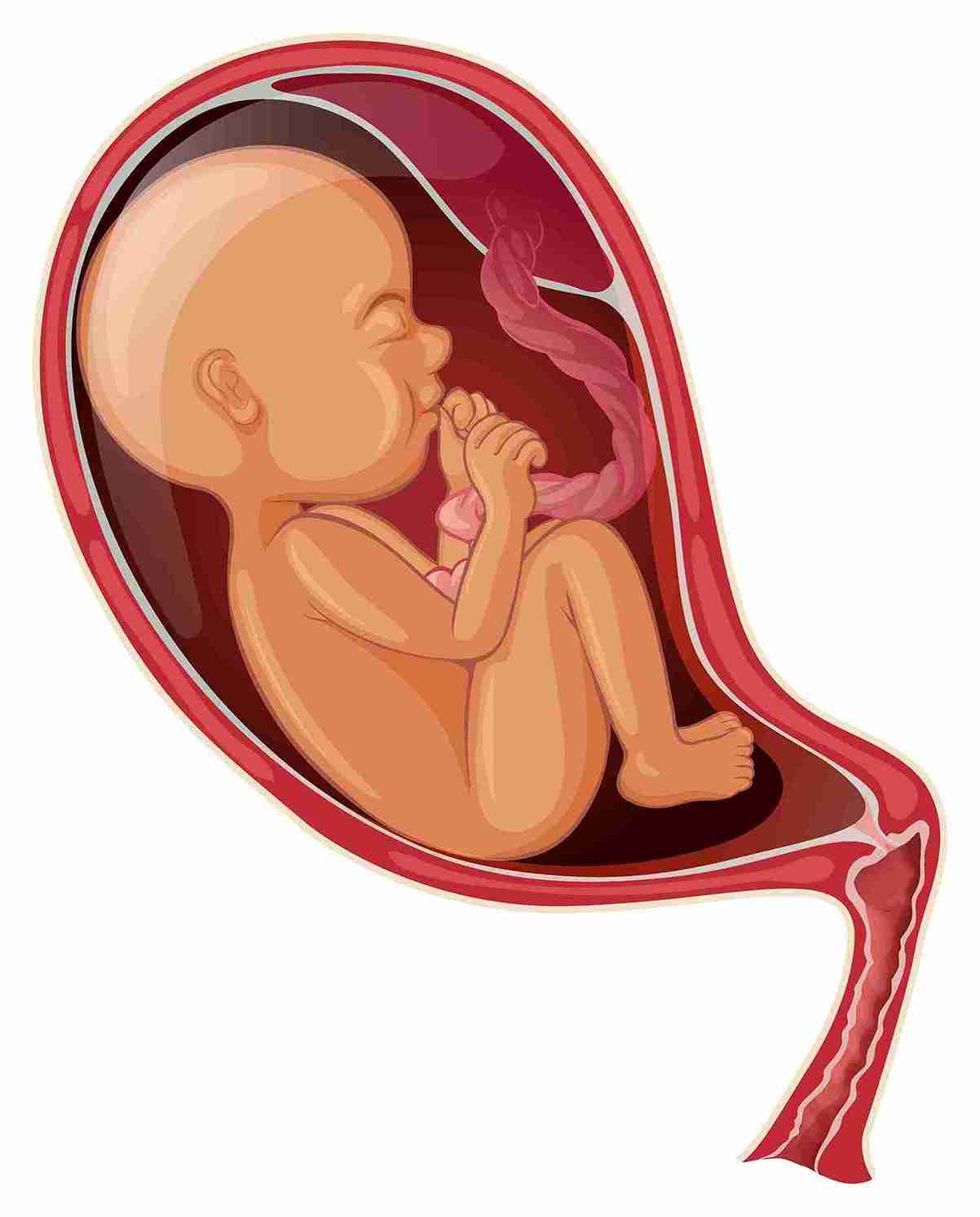 What is Placental Abruption?