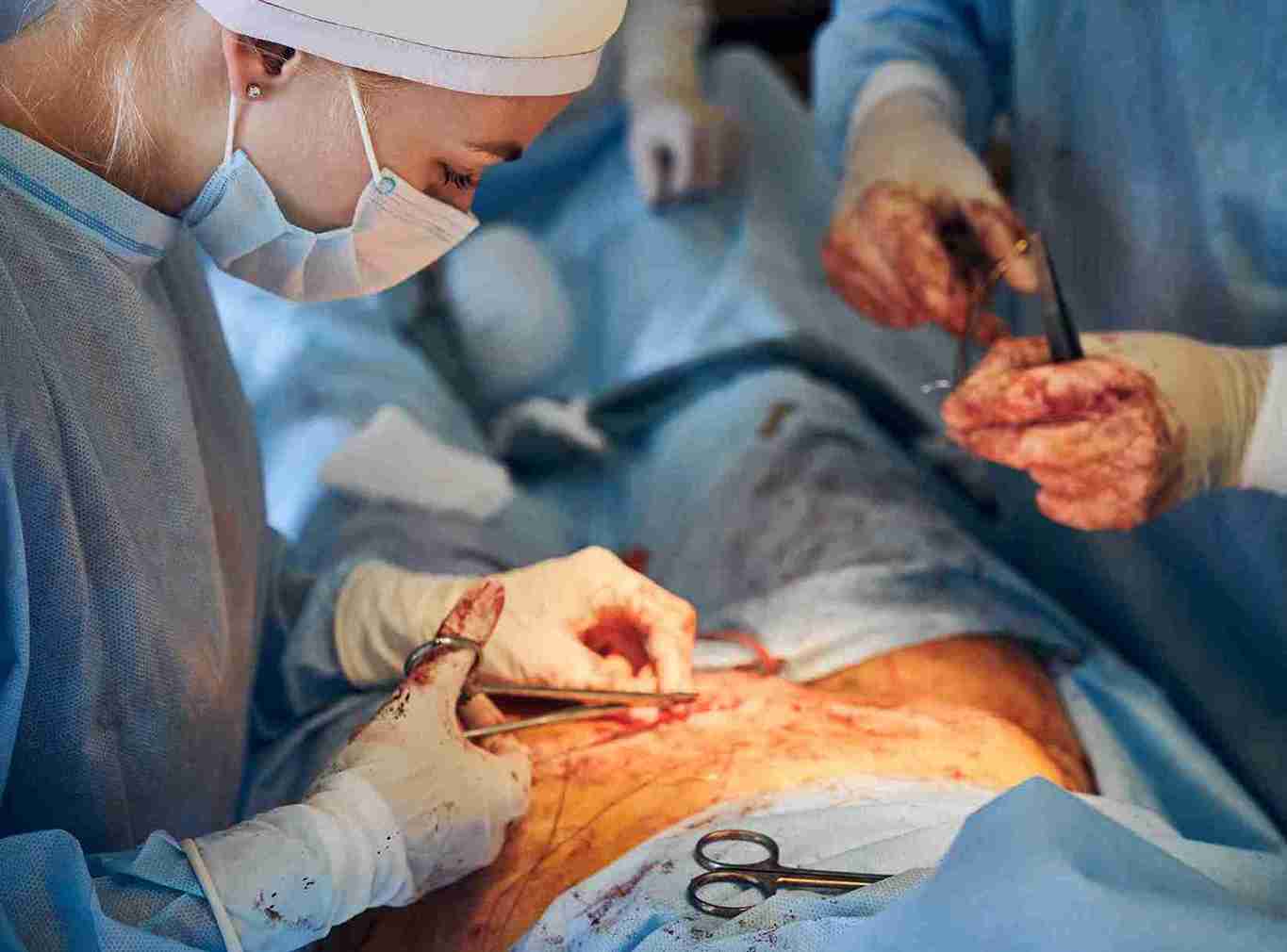 Uterine fibroids treatment is recommended for women