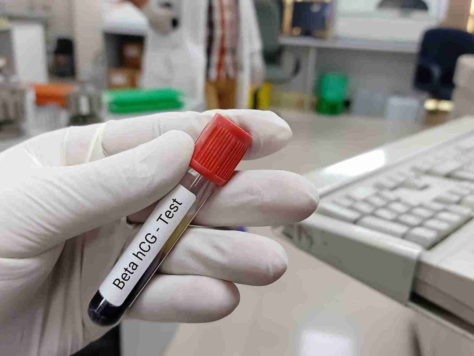 During Fertility Treatments