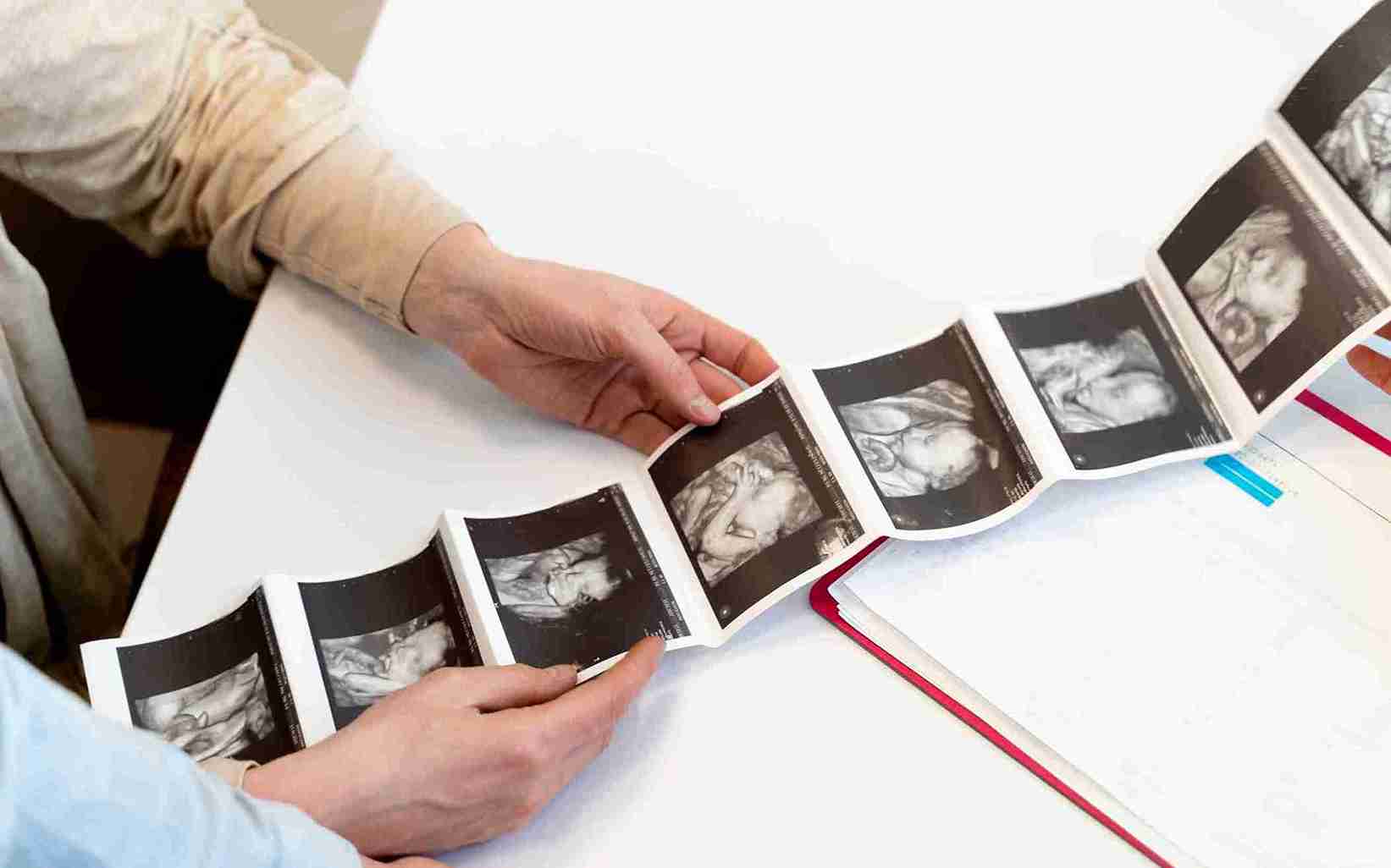 First Trimester - The Foundation is Built Here