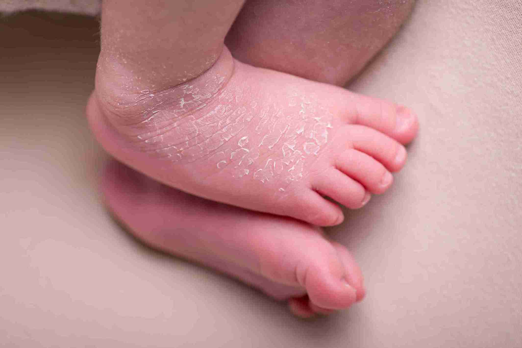 baby spends nine months in amniotic fluid