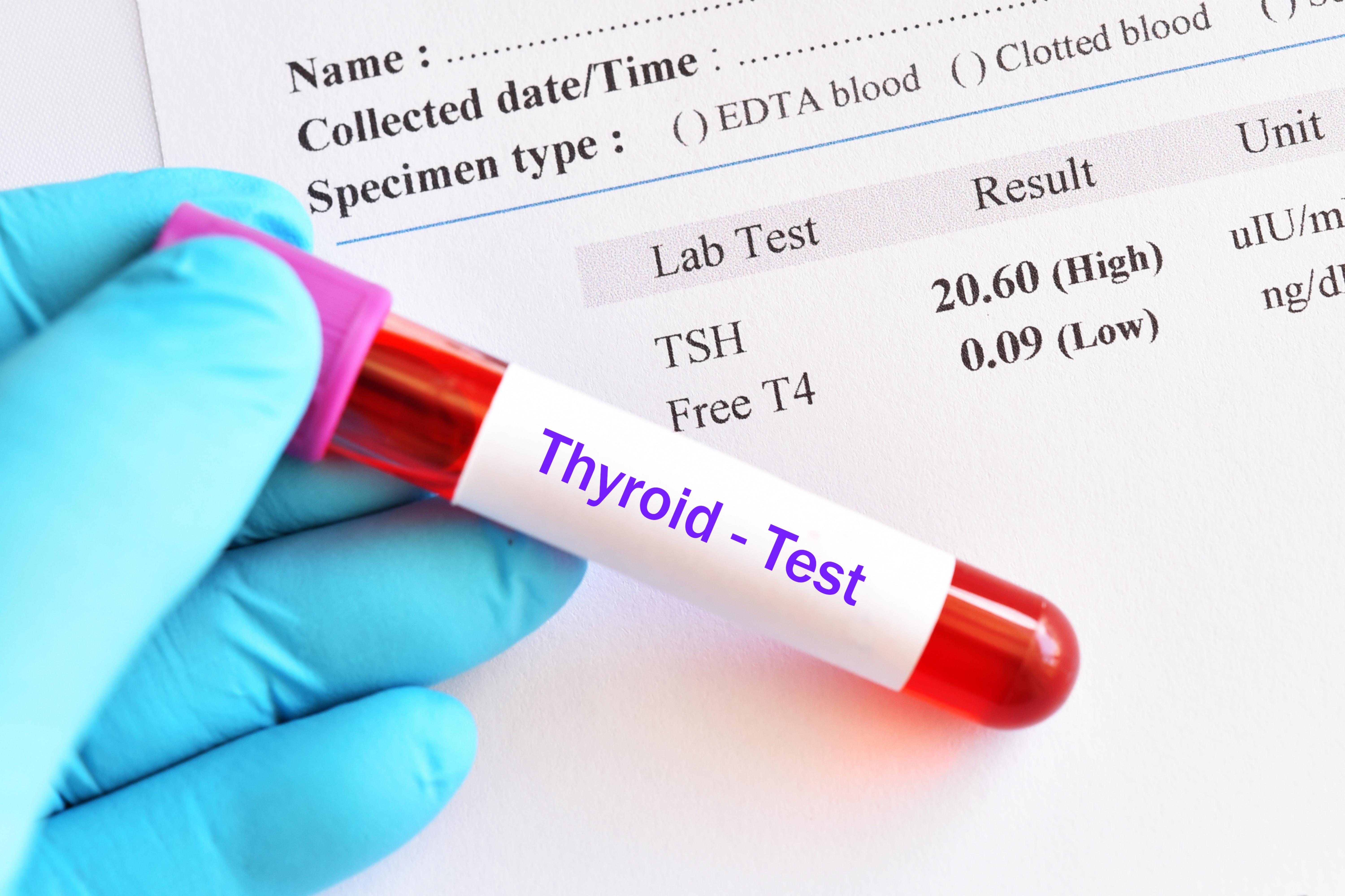 TSH levels into the appropriate range before and during pregnancy