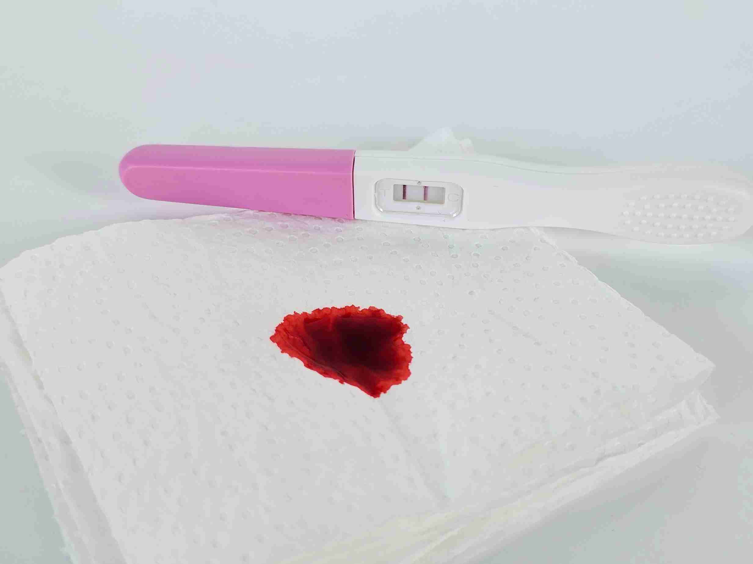 Bleeding During Pregnancy Should Never Be Ignored