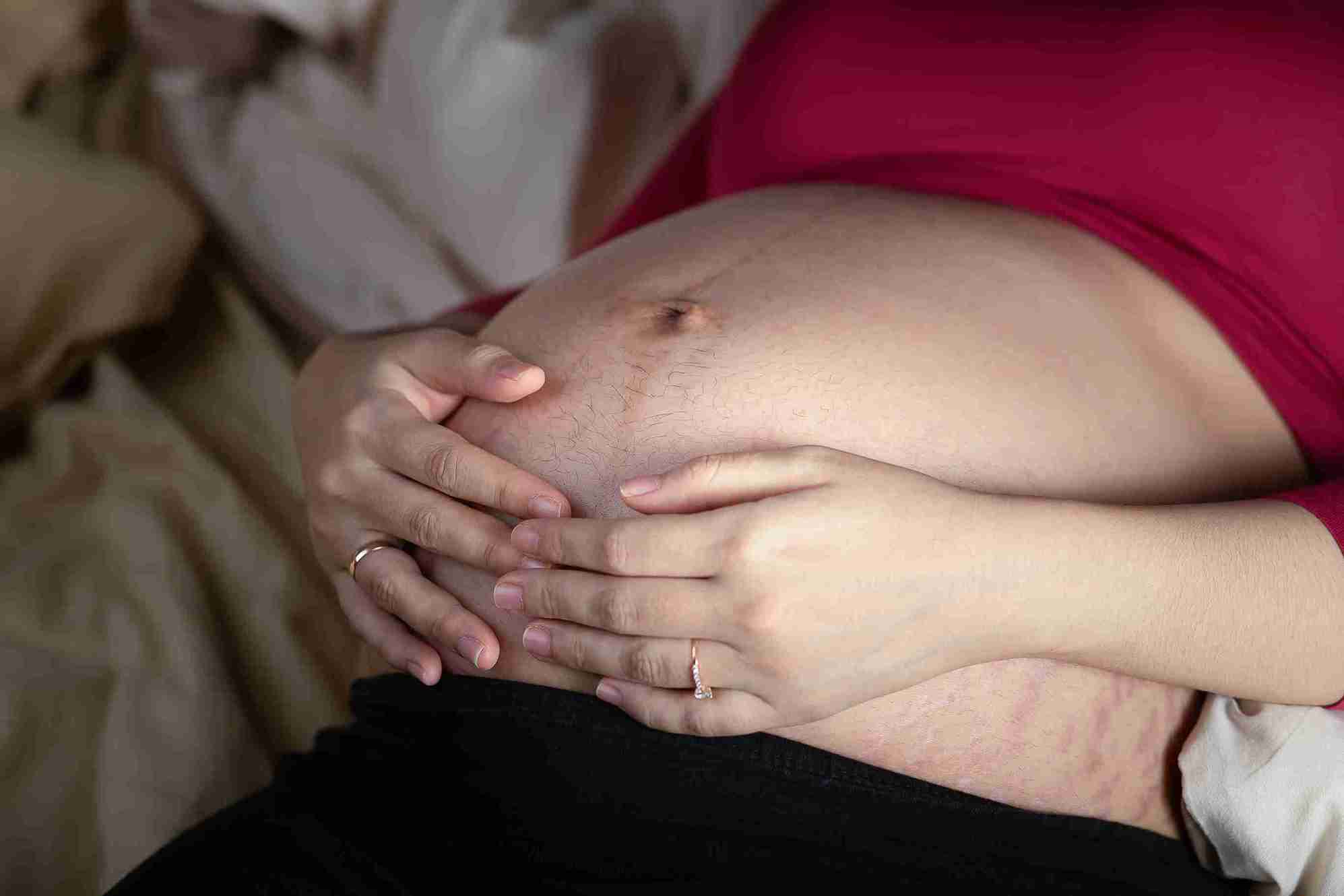What Is Single Umbilical Artery (SUA)?
