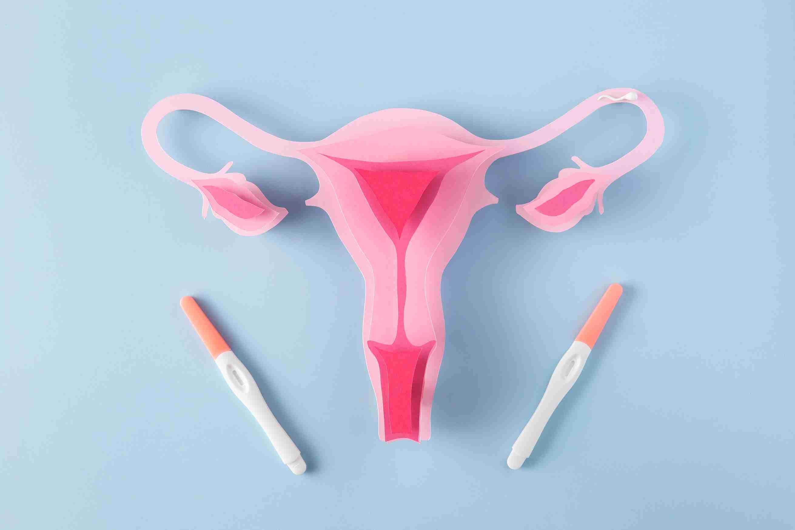 What Is a Single Intrauterine Gestational Sac?