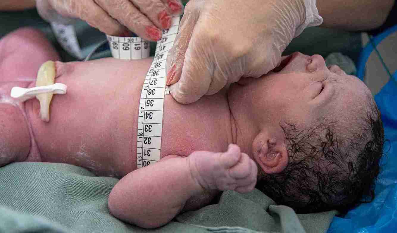 Transient tachypnea of the newborn is a condition