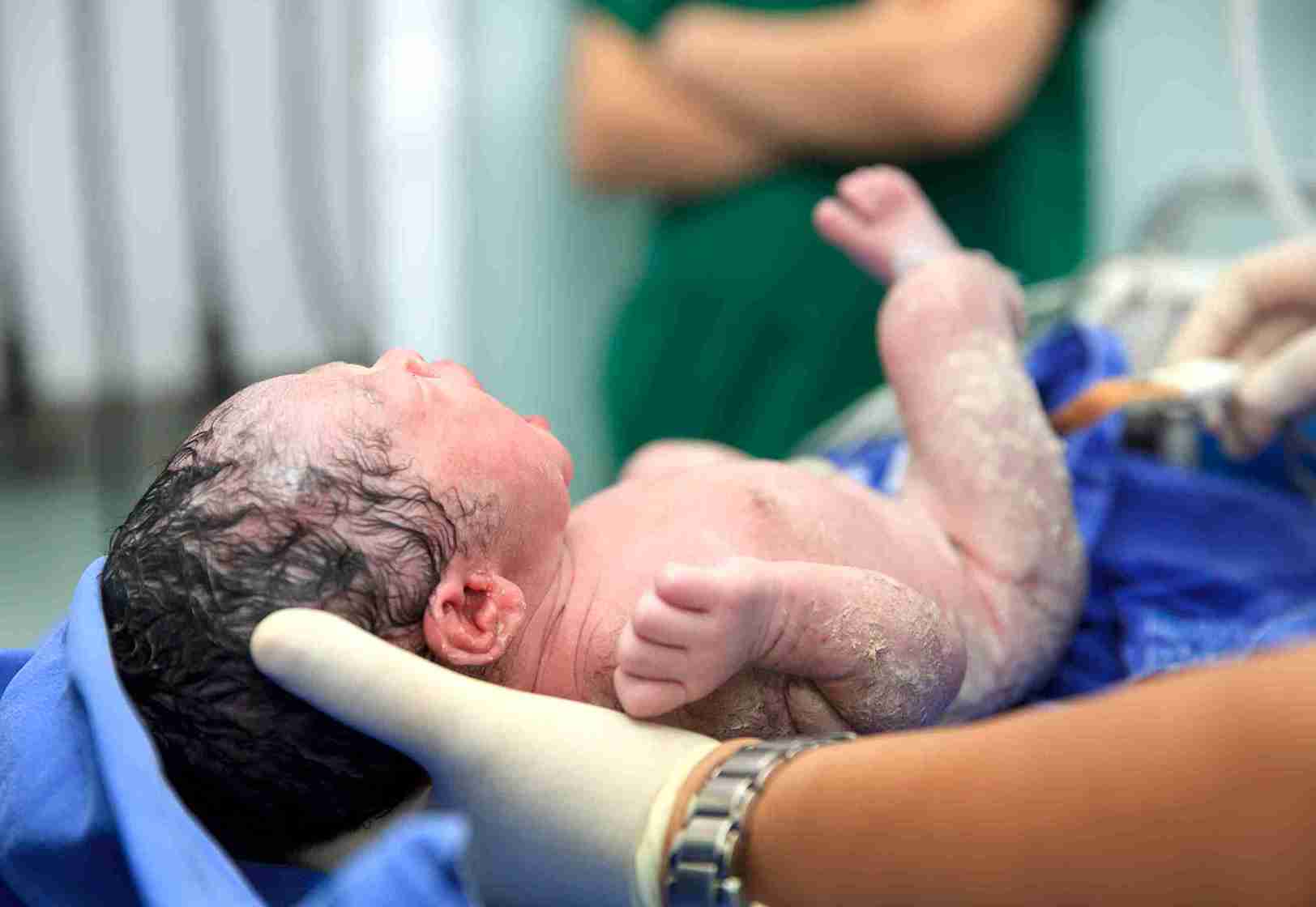 treatment involves supportive care as the baby's lungs