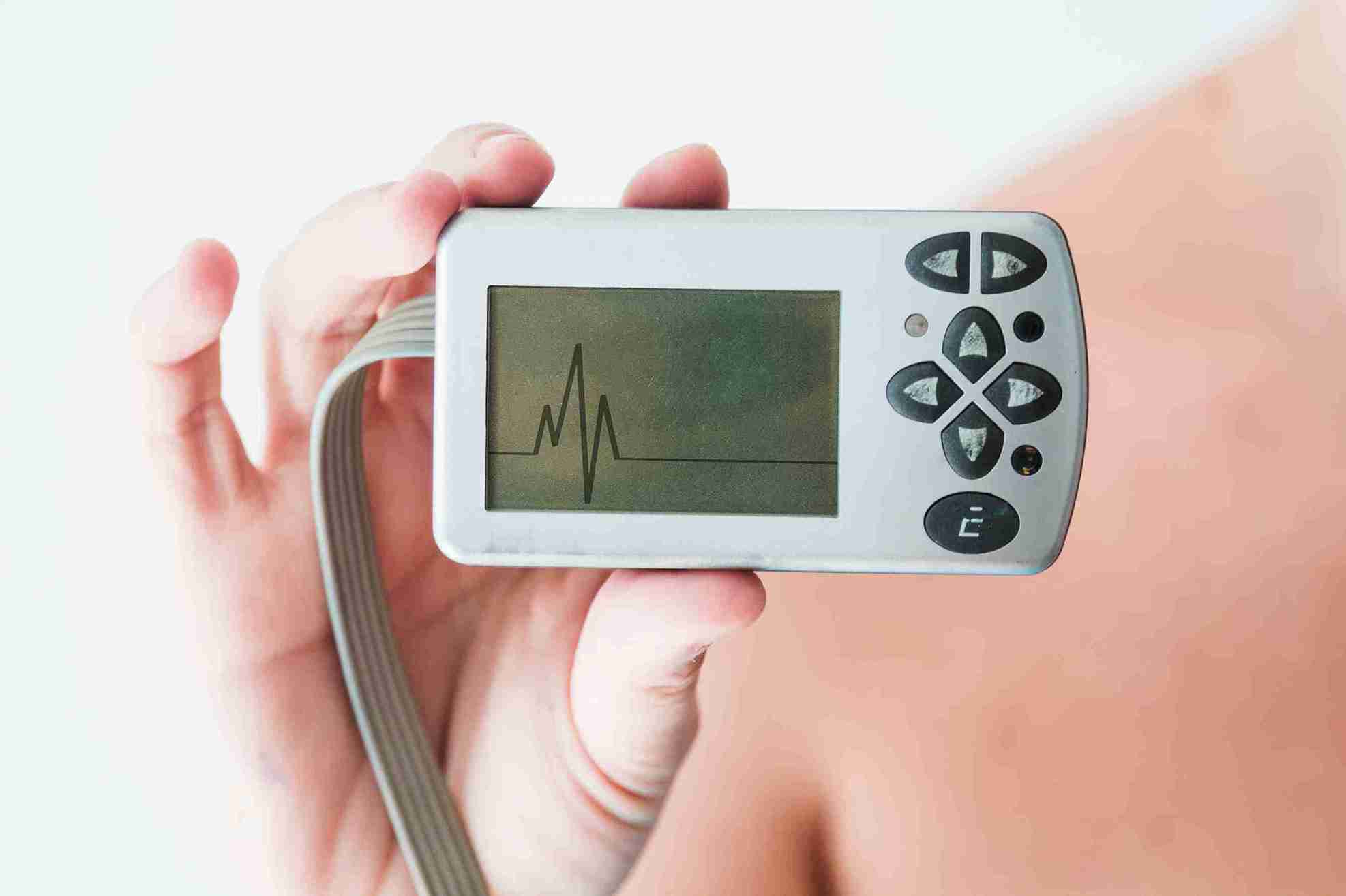 What Is Fetal Heart Rate?