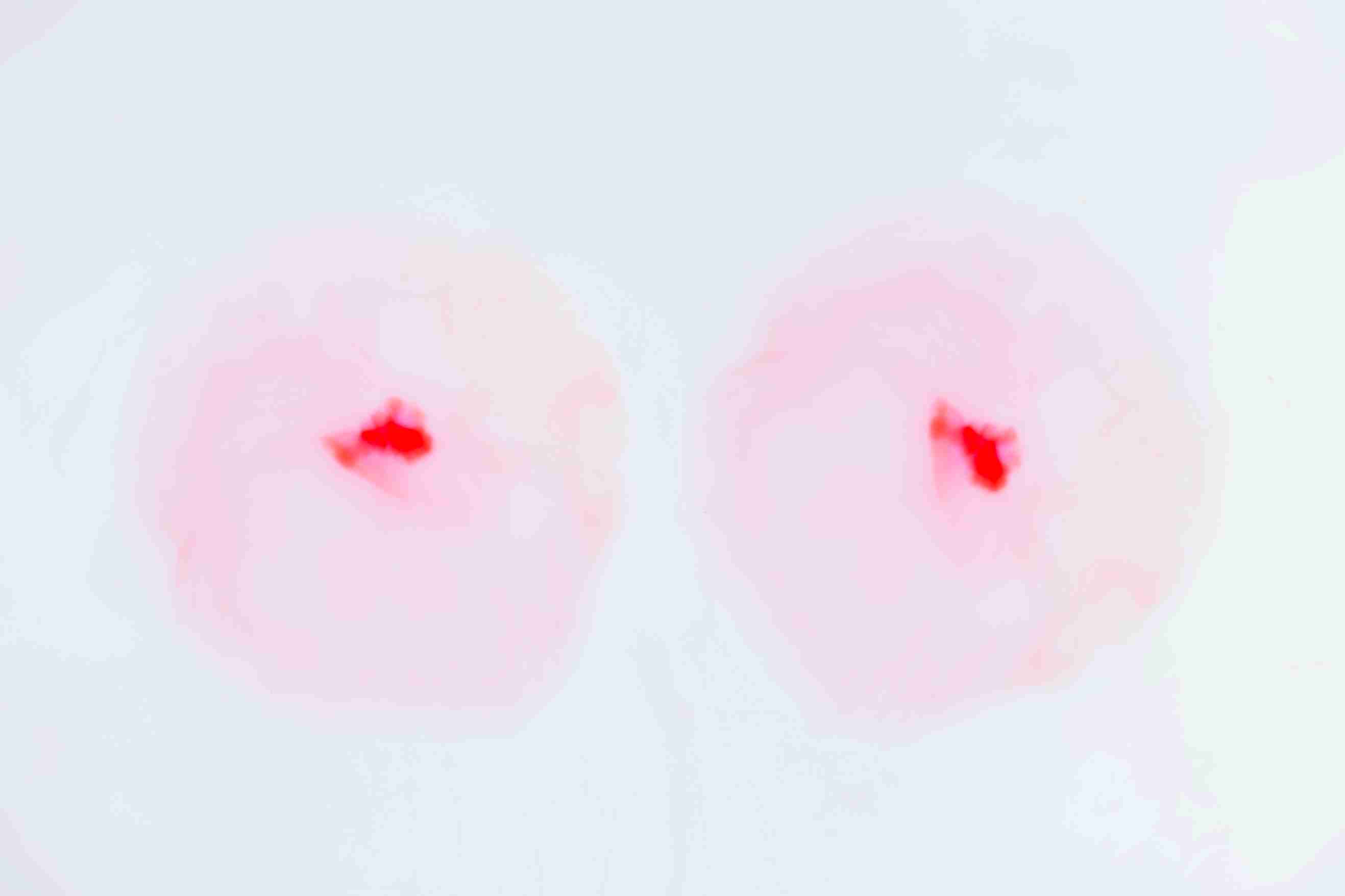 Gently squeeze each nipple between your finger and thumb.