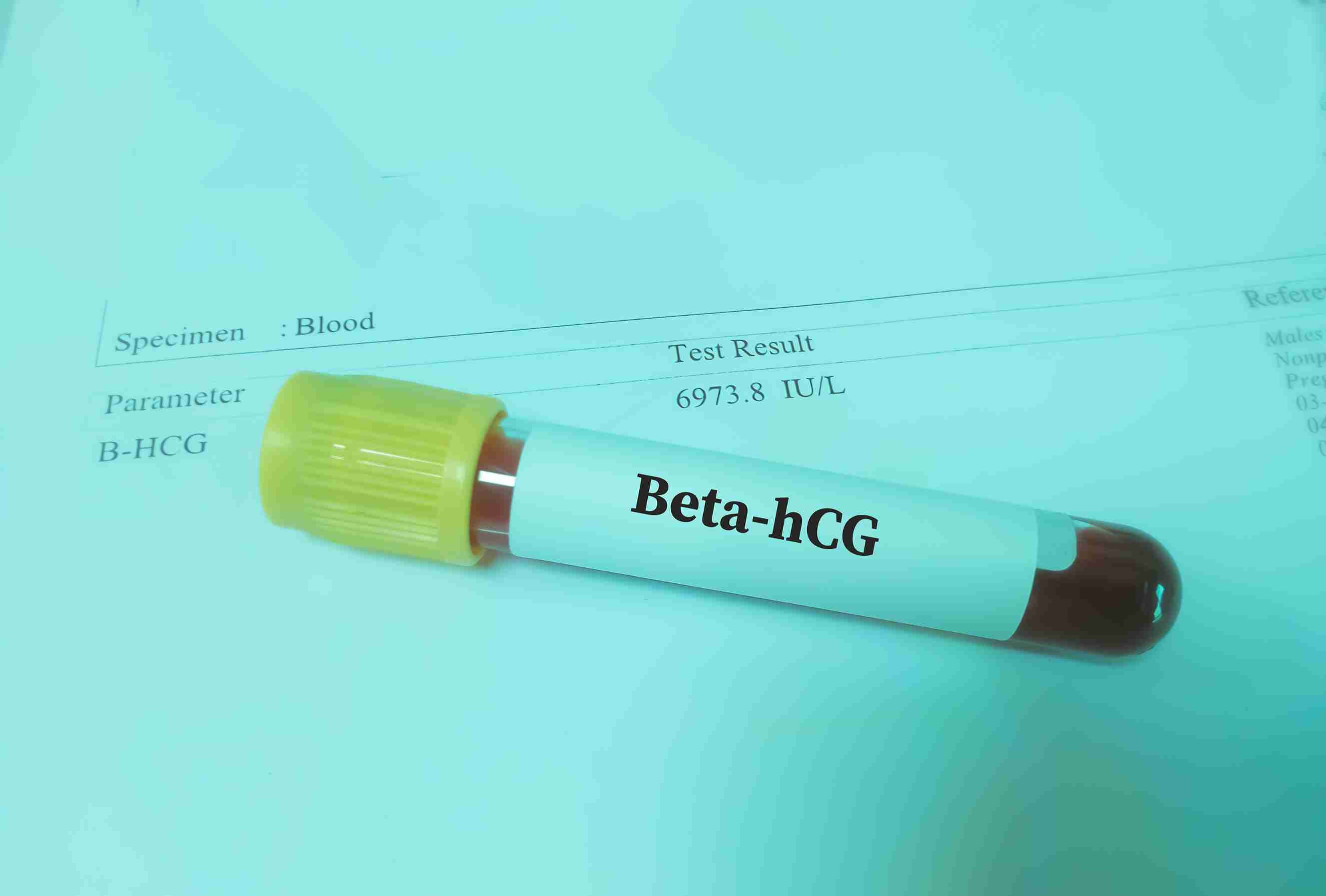 What Should You Do After a Negative Beta hCG Test?