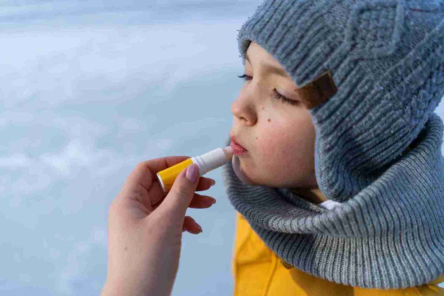 Chapped lips usually heal when the cause of irritation